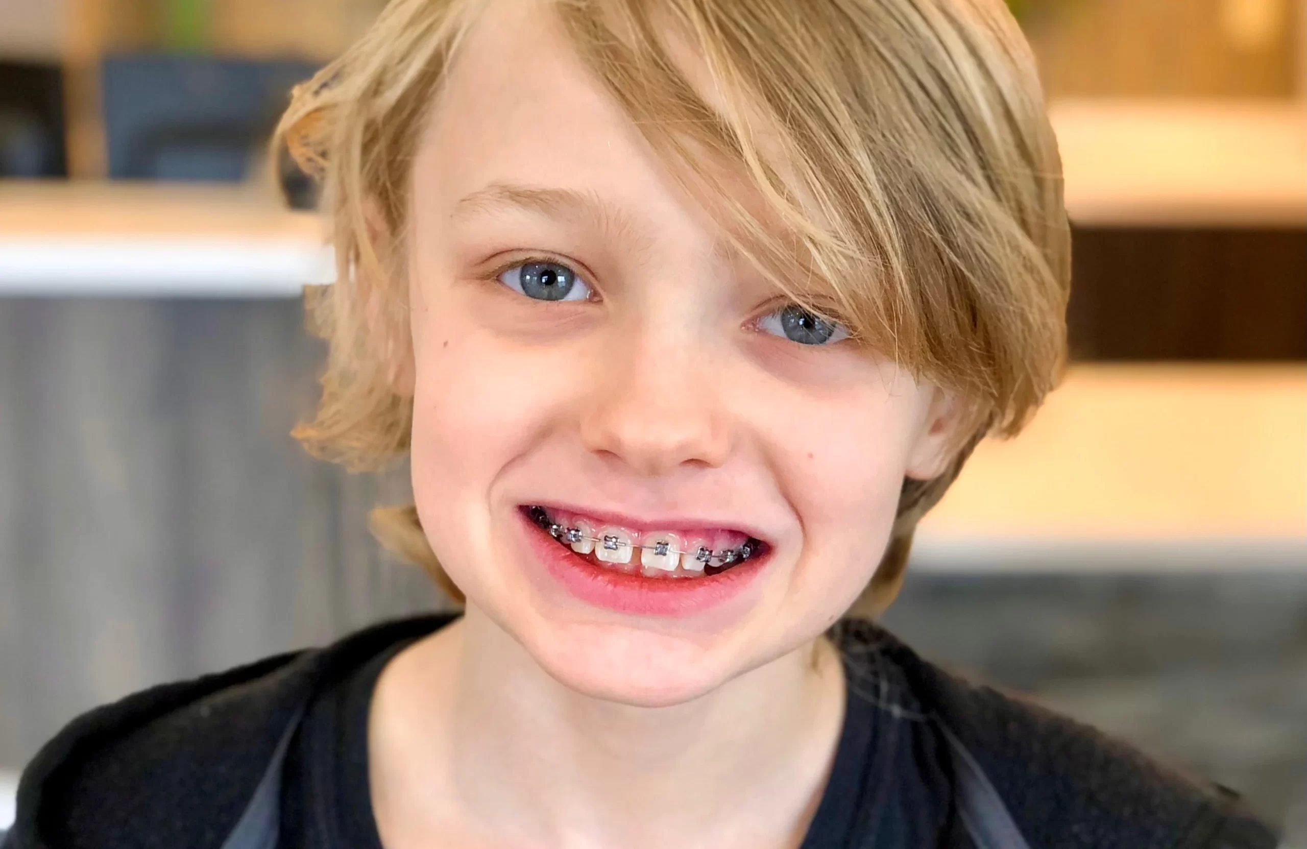 Child smiling with braces