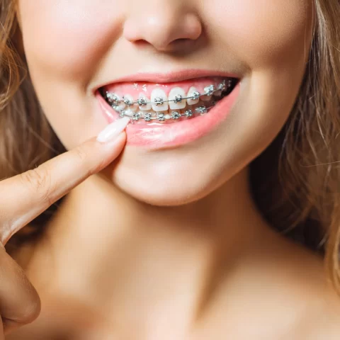 Girl showing her braces with a proud smile