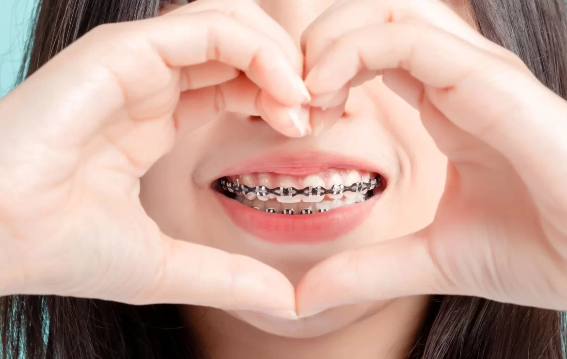 Adult Orthodontic Treatment Options: Finding the Right Fit for Your Smile