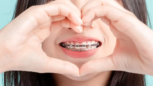 Adult Orthodontic Treatment Options: Finding the Right Fit for Your Smile