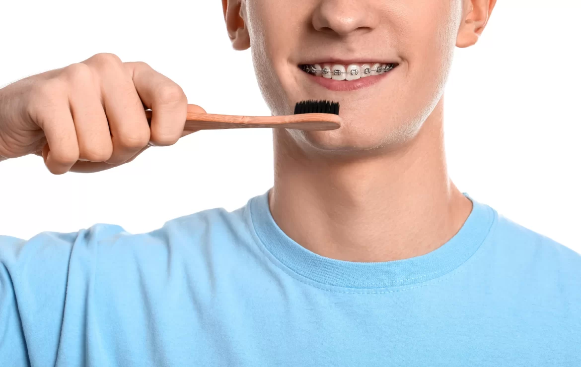 Ultimate Guide to Brushing Your Teeth with Braces