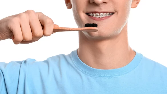 Ultimate Guide to Brushing Your Teeth with Braces