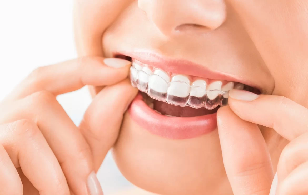 Can Clear Aligners Work if I’m Missing Teeth?