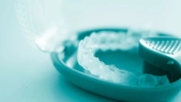 Essential Tips for Using Clear Aligners