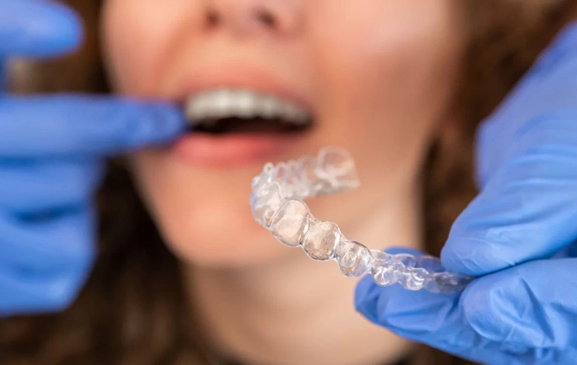 How to Minimize Discomfort with Clear Aligners