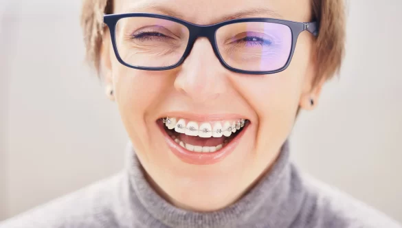 Surprising Benefits of Adult Orthodontics You Might Not Know